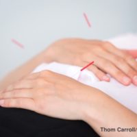In a rush? Philly acupuncturist offers 'on-the-go' treatment.